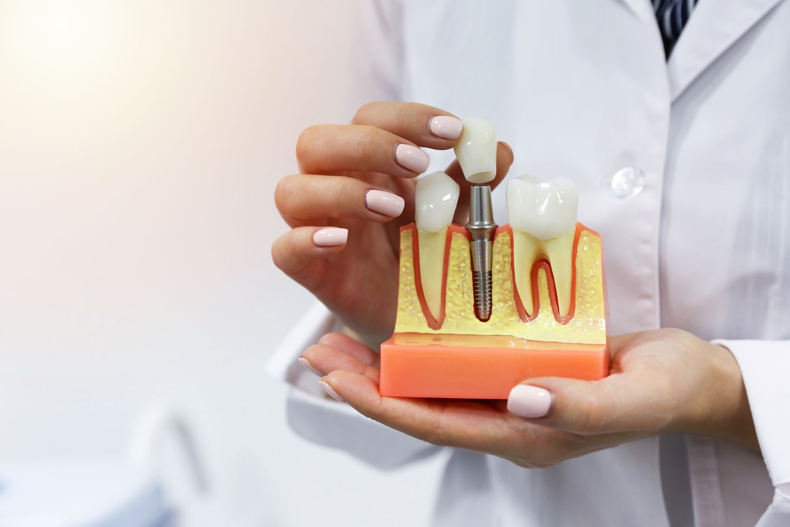 Implante Dentario Doi Depois da Cirurgia